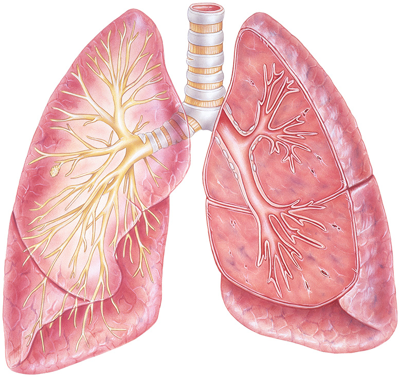 Lung and Thoracic Cancer | Northeast Georgia Health System